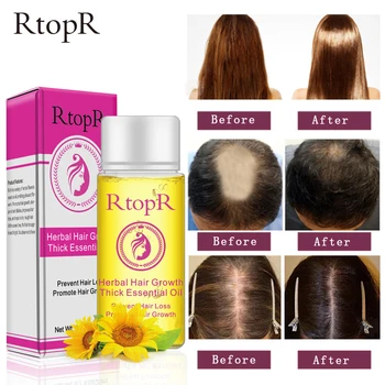 

2pcs Herbal Hair Growth Anti Hair Loss Liquid Promote Thick Fast Hair Growth Treatment Essential Oil Health Care Beauty Essence