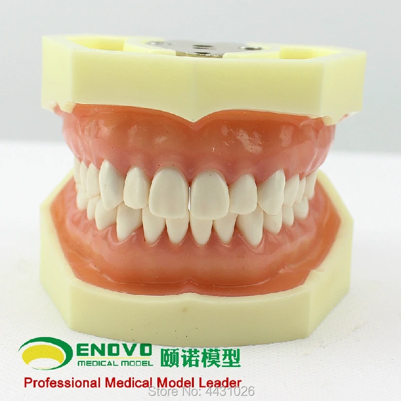 ENOVO The dental prosthesis of dental prosthesis was used to prepare the gingival prosthesis ENOVO The dental prosthesis of dental prosthesis was used to prepare the gingival prosthesis