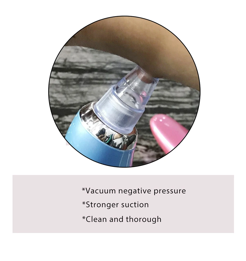 Electric Blackhead Remover (9)