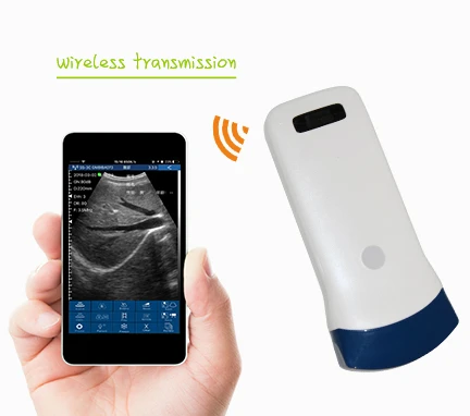 

Wireless ultrasound convex array probe Uprobe with color, CF, PW, PDI funtion