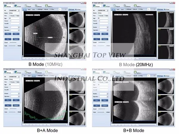 SW-2100 офтальмологическая ультразвуковая сканирующая машина a b сканирующая с usb-подключением
