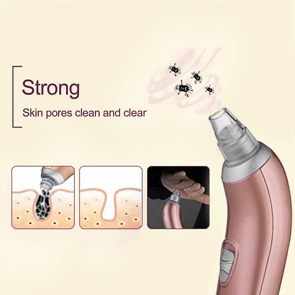 Инструмент для удаления угрей, 1 шт., электрический прибор для ухода за кожей лица, очиститель пор и угрей, вакуумный очиститель акне, инструменты для ухода за лицом