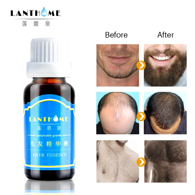 

2 Men Beard Oil Grow Hair Growth Essence Baldness Anti Hair Loss Products Ginger Oil Gingseng Hair Tonic Spray Dense Hair Serum