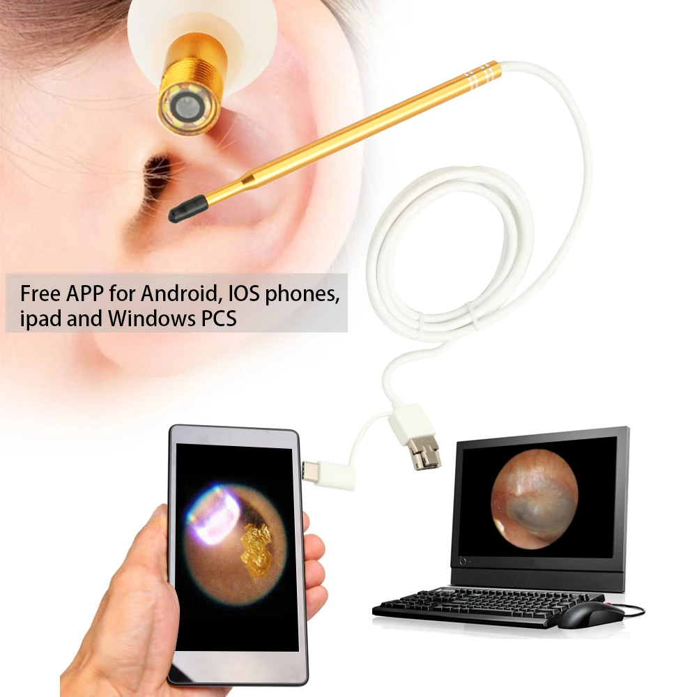 

HD0.3/1.0MP Camera Endoscope Ear Cleaning Inspection Tools 3-in-1 USB Visual Earpick With 6 LED Lights For Android/IOS/PC