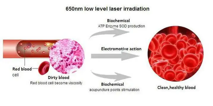 

High Blood Sugar High Blood Pressure Green Laser Level Therapy Device