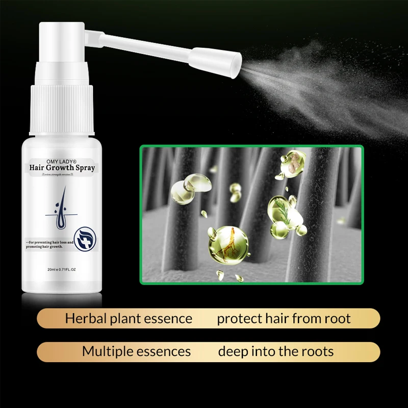 OMYLADY Anti Hair Loss Liquid Hair Growth Spray Essential Oil For Dry Hair Regeneration Repair Moisturizing Hair Care Products OMYLADY Anti Hair Loss Liquid Hair Growth Spray Essential Oil For Dry Hair Regeneration Repair Moisturizing Hair Care Products