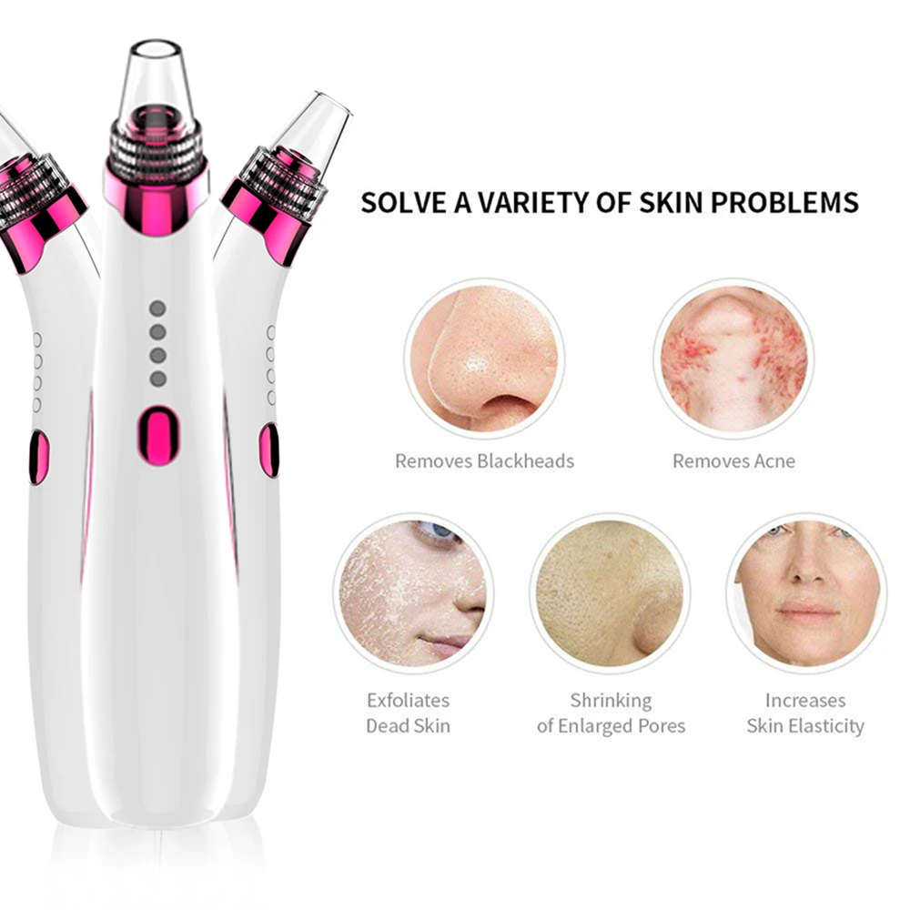 Blackhead-Remover (2)