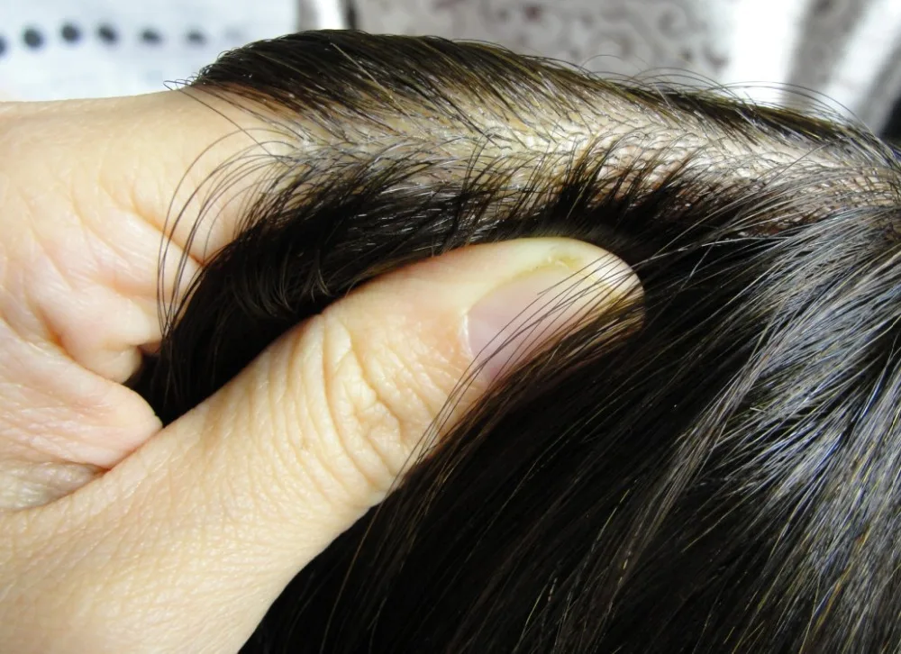 pu injection (02)