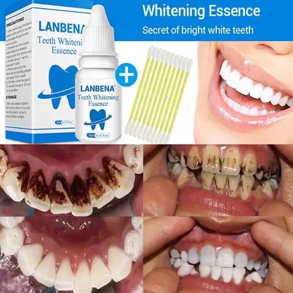 Buy Teeth Whitening Essence Oral Hygiene Cleaning