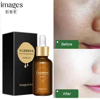 

200PCS Images of pores treatment essence Acne eel treatment acne pores face lifting skin Serum moisturizing skin care