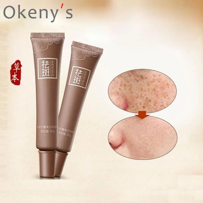 

MEIKING Dark Spot Corrector Skin Whitening Fade Cream Lightening Blemish Removal Serum Reduces Age Spots Freckles Melasma cream