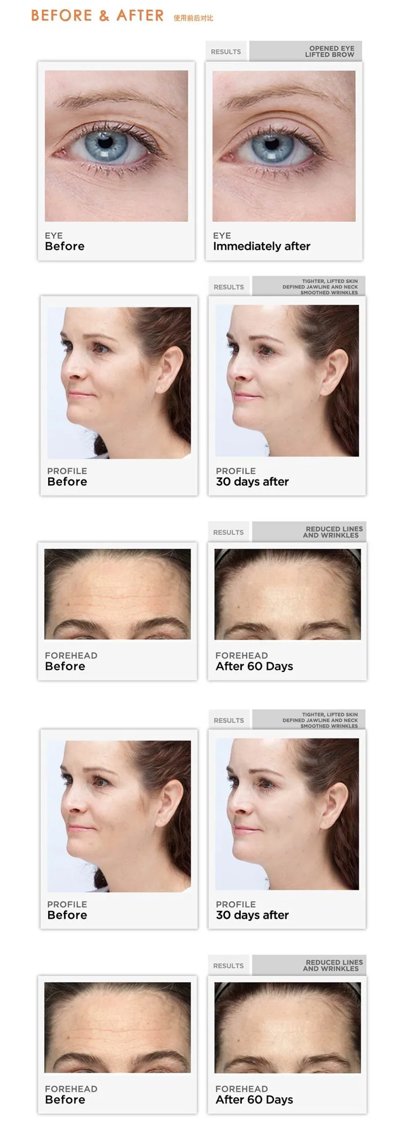 HTB18r5QNpXXXXbRXpXXq6xXFXXXJ