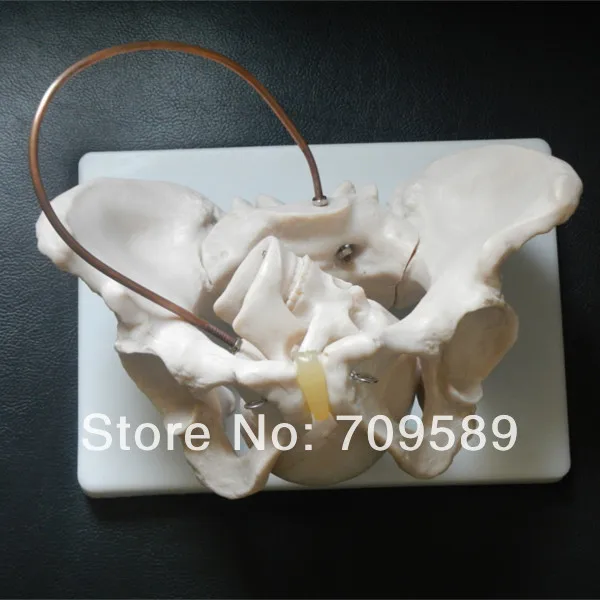 

Anatomy Pelvis Model with fetal skull, Birth Demonstration Model