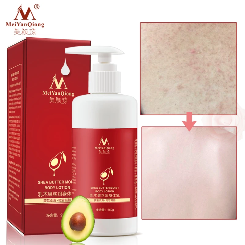 Shea Butter Moist Body Lotion Skin Care Body Creams Nourishing Antibacterial Moisturizing Whitening Smooth Beauty & Health Shea Butter Moist Body Lotion Skin Care Body Creams Nourishing Antibacterial Moisturizing Whitening Smooth Beauty & Health