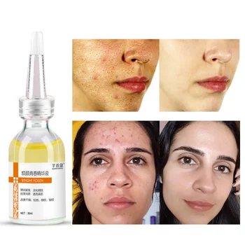 

2019 Natural Plant Extract Face serum Hyaluronic Acid Liquid Whitening Blemish essence Mosturizing Anti-acne