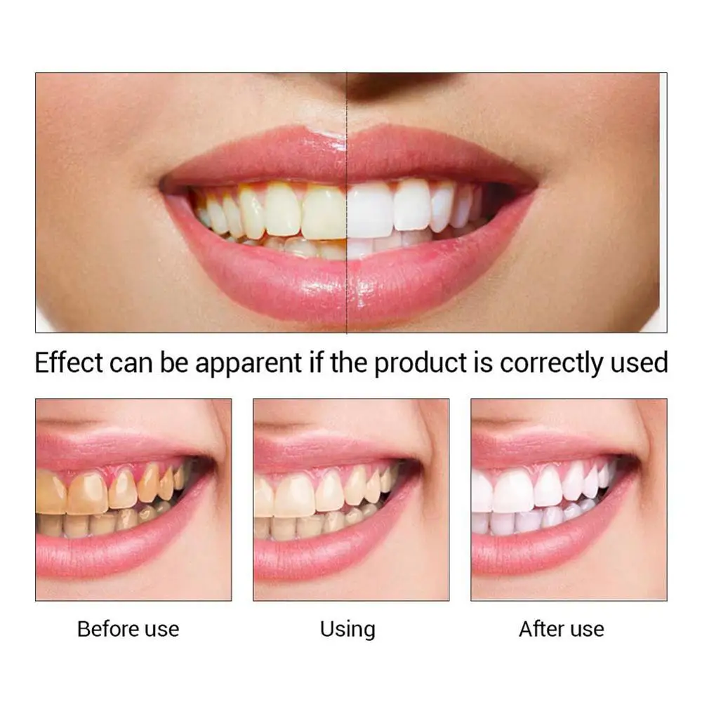 10ml Teeth Whitening Essence Oral Hygiene Cleaning Serum Powder Eliminates Plaque Teeth Teeth Whitening Tools Paste 5