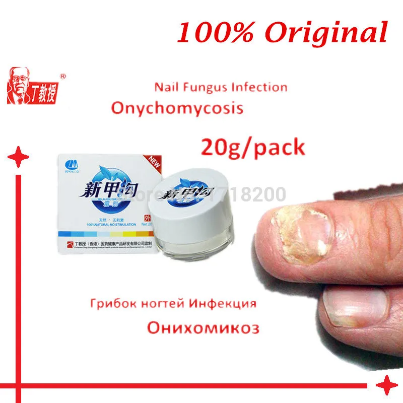 1 Pcs Nail Treatment Cream For Onychomycosis Paronychia Cures / Anti