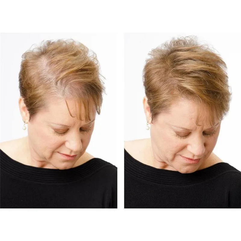 inspire-uplift-anti-hair-loss-fibers-anti-hair-loss-fibers-3529626157172_1000x