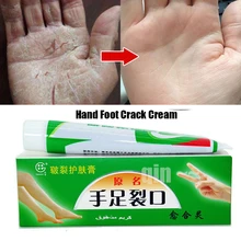 2 шт./лот, Китайская косметика, для рук, крем от трещин, пятки, обветренный пилинг, ремонт, анти-сухая трещина, мазь, отшелушивающий крем для ног