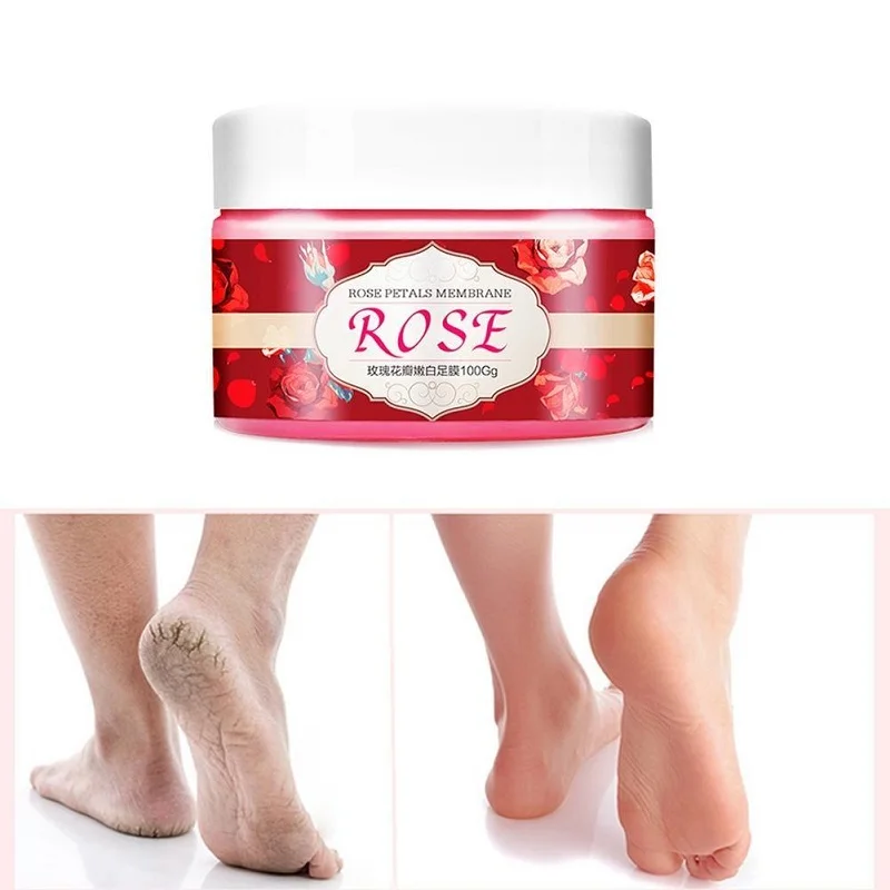 New Rose Nail Paraffin Wax Fungal Nail Treatment Wax Sleek Smooth Exfoliation Skin Moisturizing Whitening Fine Lines Hand Care