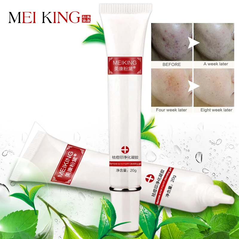 MEIKING Face Cream Acne Scar Gel Cream Remove SKin Care Acne Treatment
