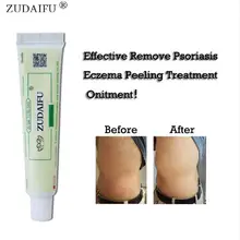 Выделенные звенья Сера антибактериальные ZUDAIFU ручной работы китайский травяной натуральный Restrain