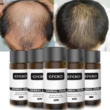 Efferent мощный сыворотка эфирное масло для роста волос, чтобы предотвратить выпадение волос профессиональные продукты для волос растут толще