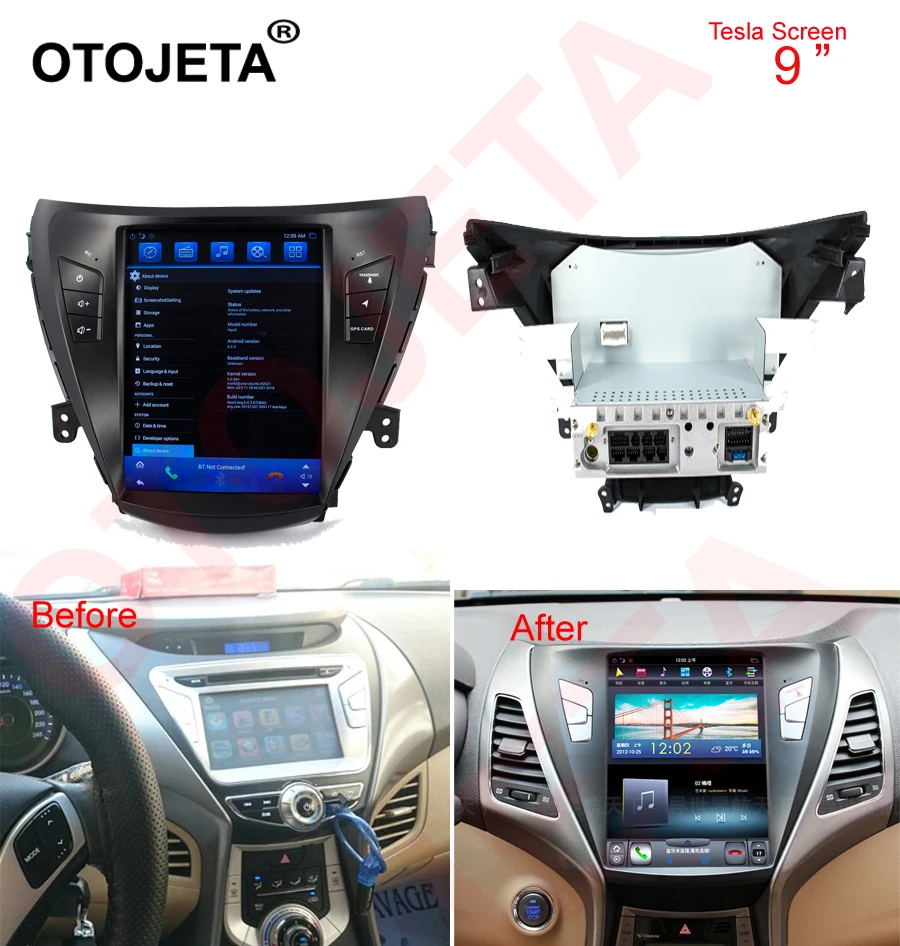 

Otojeta vertical screen tesla head units quad core 32gb rom Android 7.1 Car Multimedia GPS Radio player for Hyundai Elantra 2011