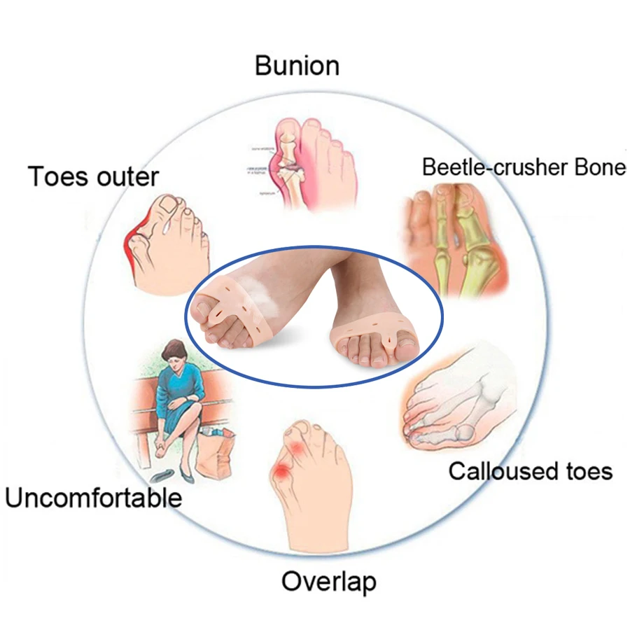 2 шт. гелевый силиконовый корректор Bunion разделитель большого пальца разделитель инструмент для ухода за ногами Hallux Valgus Профессиональный массажер Z27901