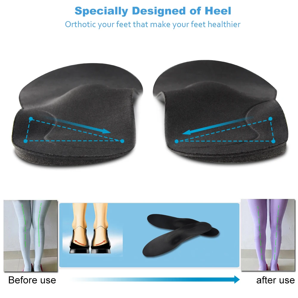 Массажные ортопедические стельки с поддержкой свода стопы для женщин|arch support