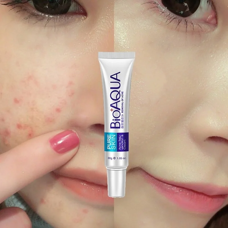 

Face Primer Cream Acne Spot Removing Moisturizer Oil-control Shrink Pores Facial Care Smooth Makeup Reduce Blemishes