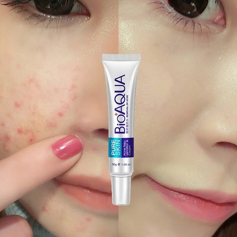 Сыворотка Для Лица Против Акне Beauty Купить