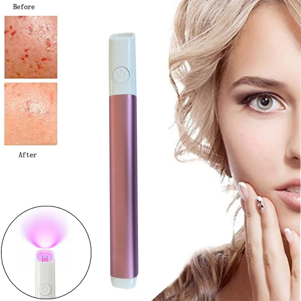 Portable Blue Light Therapy Acne Laser Pen Soft Scar Ance Treatment Wrinkle Removal Device 2019