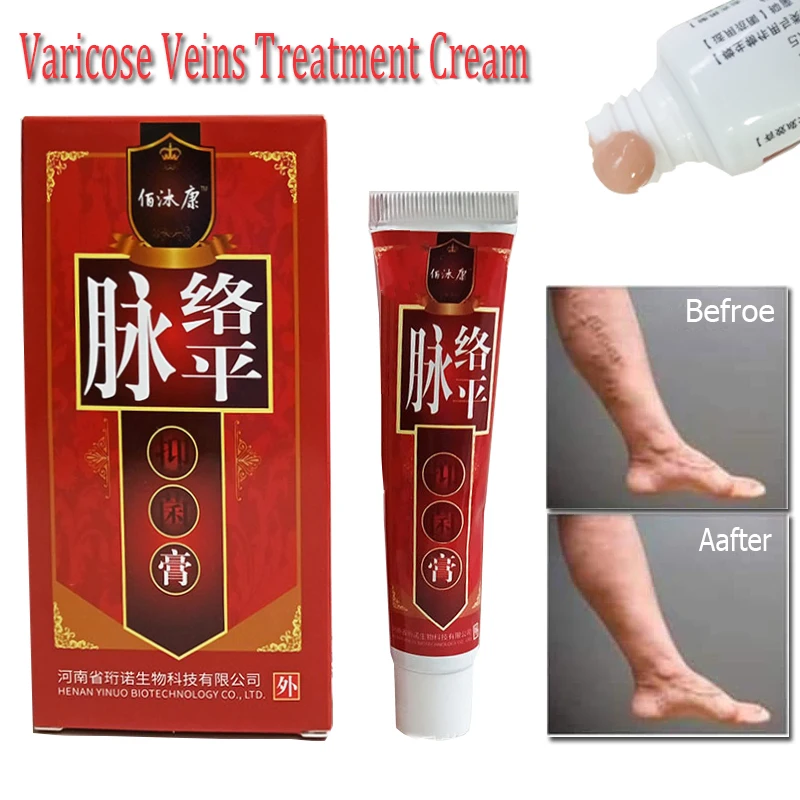 

Varicose Veins Treatment Cream Ointment Vasculitis Phlebitis Angiitis Inflammation Blood vessel Rotten legs Varicose Veins Cream