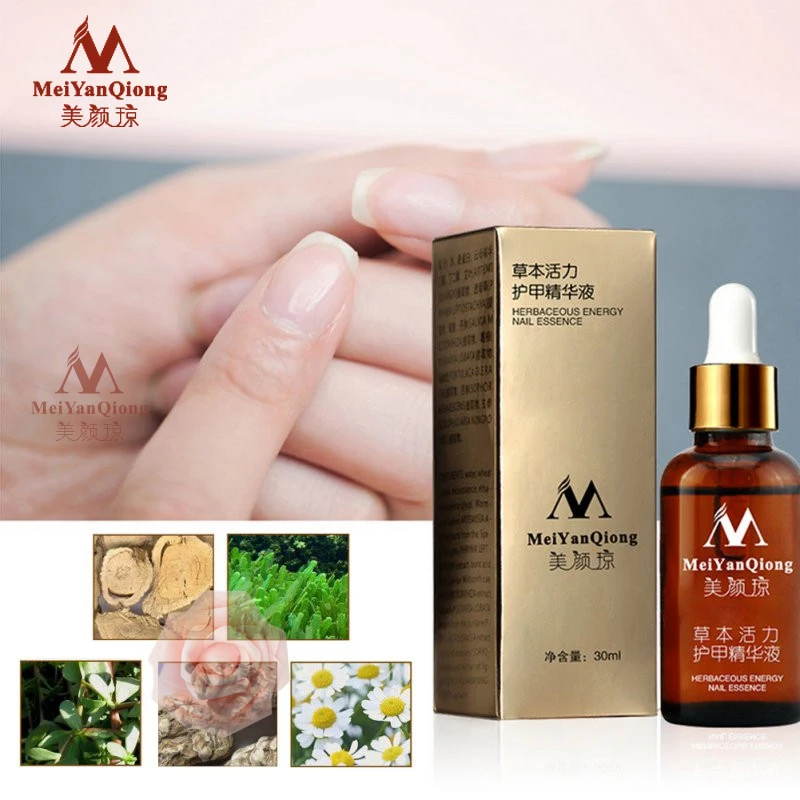 Fungal Nail Treatment Feet Care Essence Nail Foot Whitening Toe Nail Fungus Removal Gel Anti Infection Paronychia Onychomycosis