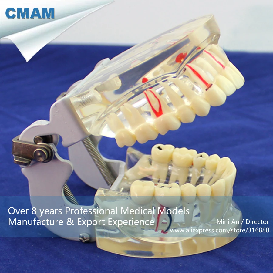 12566/человеческие стоматологические демонстрационные модели пародонтальных кариес, обучение медицине анатомических моделей