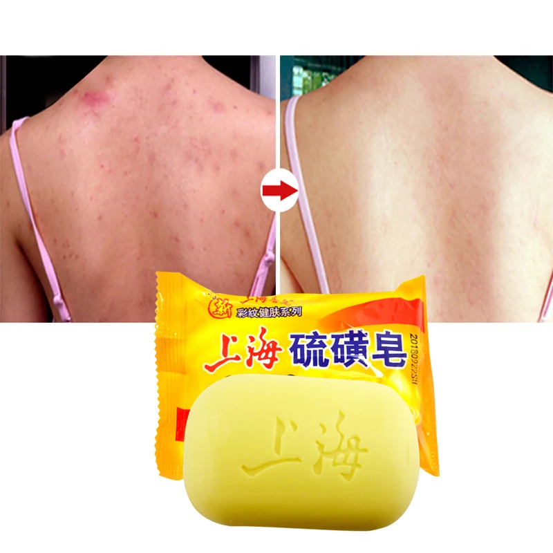 Сульфатное мыло Шанхай масло-контроль акне лечение угрей мыло 95 г отбеливание очищающее средство Китайский традиционный уход за кожей