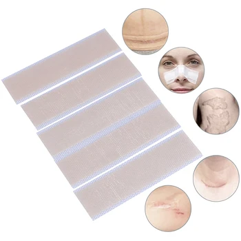 

5PCS Skin Repair 0.4mm Reusable Silicon Patch Remove Trauma Burn Sheet Scar Removal Patch Acne Gel Therapy