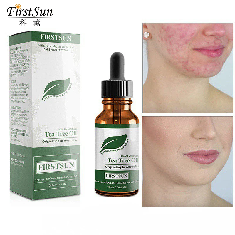Pure Tree Tea Essential Oils Moisturizing Face Skin Massage Oil Control Fade Acne Scar Removal Cystic Treatment Blackhead Pore
