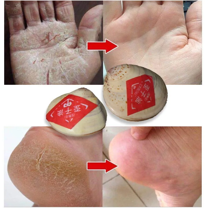 

Traditional Chinese Cosmetic Clam Oil Mini Hand Cream Hand Feet Lotion Moisturizer Prevent Cracking Anti Dry Hand Foot Care 5pcs