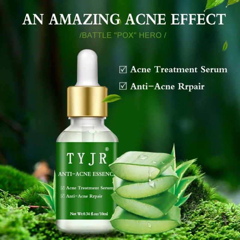 

Aloe Acne Essence Liquid Acne Whitehead Blackhead Shrink Pores Repair Skin Hydrating Anti-Aging Facial Care 10ML