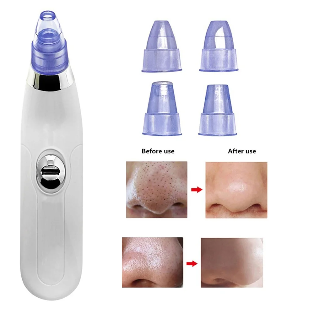 

1pcs Vacuum Pore Cleaner Blackhead Remover Electric Acne Clean Skin Care Deep Cleansing Face Deep Pore Acne Dropshipping