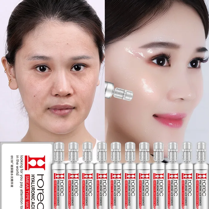 ROREC needle whitening Smear Hyaluronic acid Serum/ Essence Watery