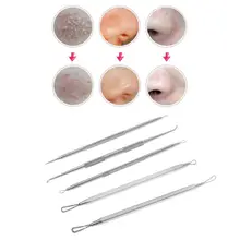 5 шт./компл. инструмент для удаления прыщей, инструмент для удаления черных точек прыщей иглы Набор по уходу за кожей