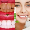 Magic Natural Teeth Whitening Gel Pen Oral Care Remove Stains Tooth Cleaning Teeth Whitener ToolsDental Toothpaste ► Photo 2/6