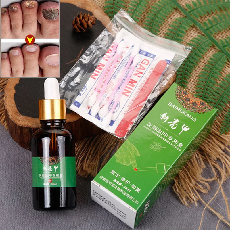Onychomycosis Special Liquid Nail Repair Sterilization Enhanced Nail