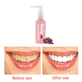 

Tooth Care Natural Stain Removal Whitening Toothpaste Stain Toothpaste Fight Bleeding Gums Fresh Toothpaste Y711