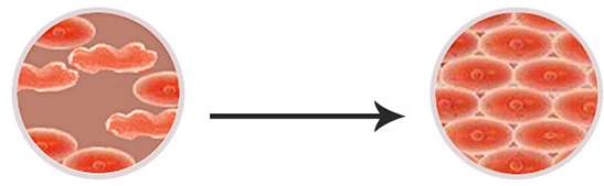 EMS