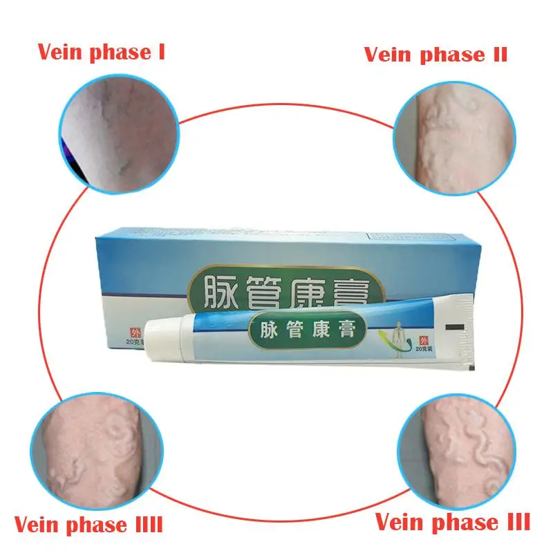 DUS 10 шт. варикозный медицинский препарат против варикозного расшрения вен крем лечение против ног васкулит флебит травяной продукт медицинский пластырь - Цвет: 10PCS