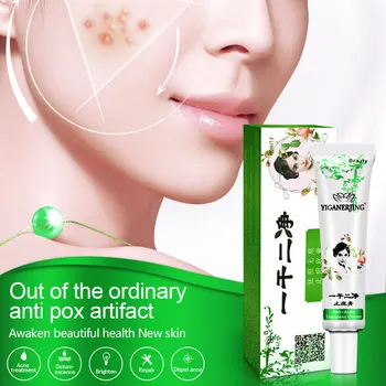 

1pc Face Acne Cleaning Cream Skin Care Remove Repair Comedone Pimple Acne Quickly Face Acne Cream Remover Anti Acne Treatment